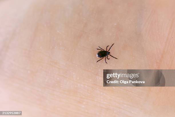Exploding Ticks 399 Tick Bite Image Stock Photos, High-Res Pictures, and Images - Getty ...