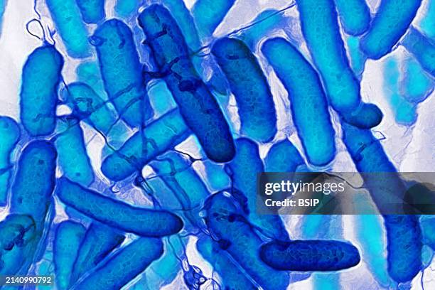 Escherichia coli that resides in the digestive tract of humans and warm-blooded animals, it is the cause of food poisoning. Electron microscopy.