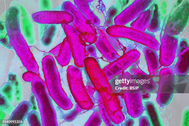 Escherichia coli that resides in the digestive tract of humans and warm-blooded animals, it is the cause of food poisoning. Electron microscopy.