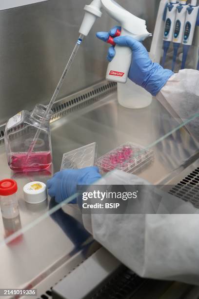Research on chronic bacterial infections within Inserm. PhD student working on brucellosis bacteria.