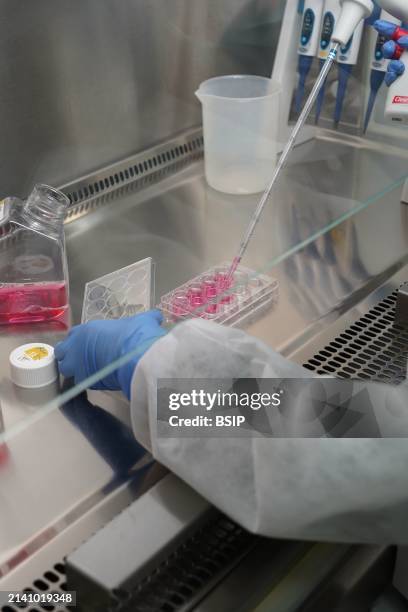 Research on chronic bacterial infections within Inserm. PhD student working on brucellosis bacteria.