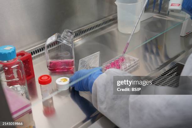 Research on chronic bacterial infections within Inserm. PhD student working on brucellosis bacteria.