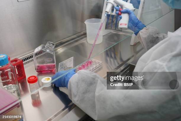 Research on chronic bacterial infections within Inserm. PhD student working on brucellosis bacteria.