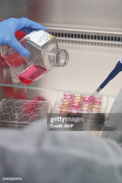 Research on chronic bacterial infections within Inserm. PhD student working on brucellosis bacteria.