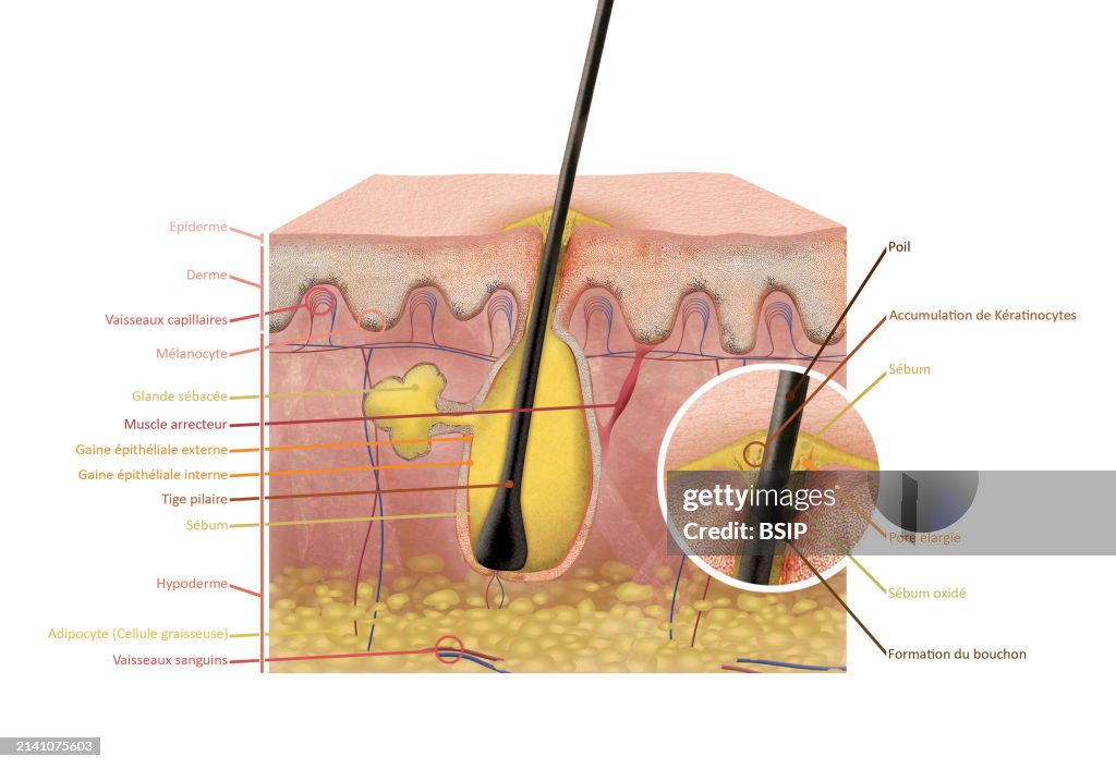 Cut skin with pimple