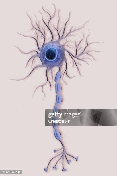 Multipolar neuron .