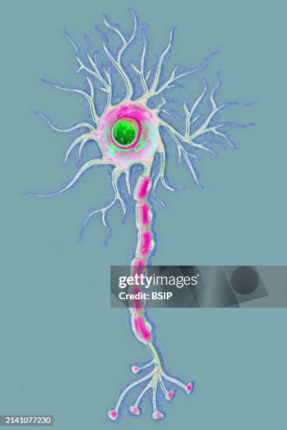 Multipolar neuron .