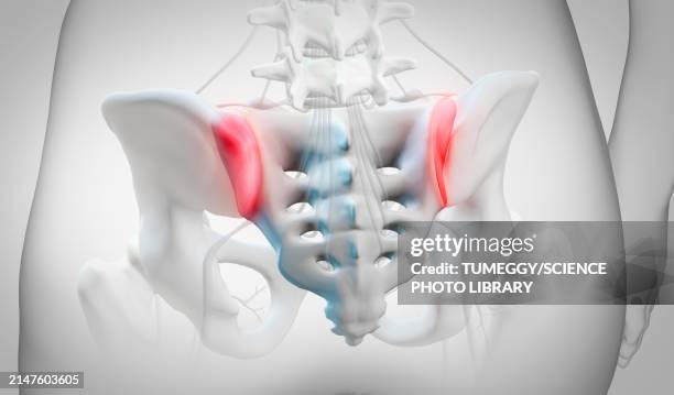 inflammation of sacroiliac joints, illustration - lower back stock pictures, royalty-free photos & images