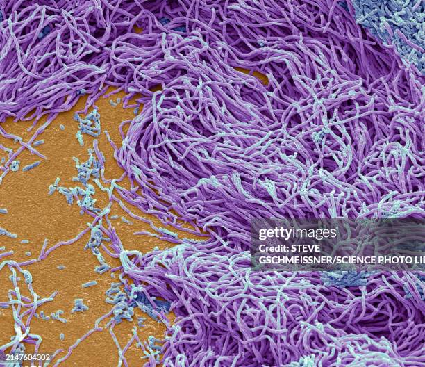 Beaded Rods Microscope 112 Rod Shaped Bacteria Microscope Stock Photos, High-Res Pictures, and ...
