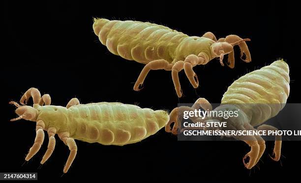 head lice, sem - rasterelektronenmikroskop stock-fotos und bilder