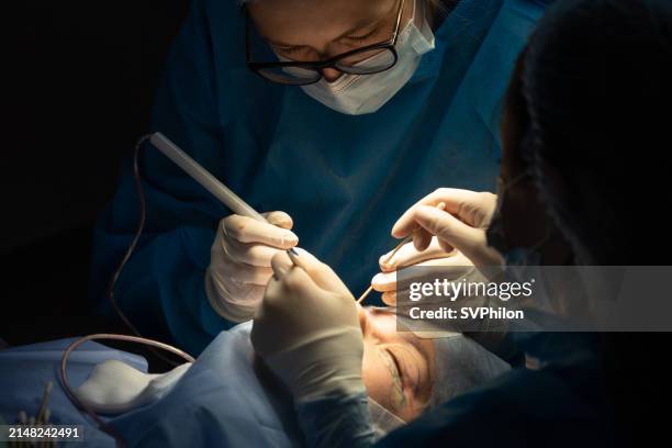 the plastic surgeon performs blepharoplasty surgery. - plastische chirurgie stockfoto's en -beelden