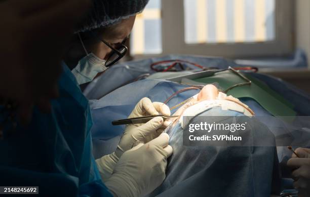 the plastic surgeon performs blepharoplasty surgery. - suture stock pictures, royalty-free photos & images
