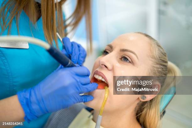 young woman having her teeth checked during appointment at dentist's office. s - plaque remover stock pictures, royalty-free photos & images