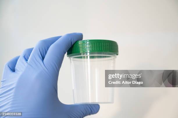 medical personnel hold a container to collect samples for laboratory analysis. - tabouret photos et images de collection
