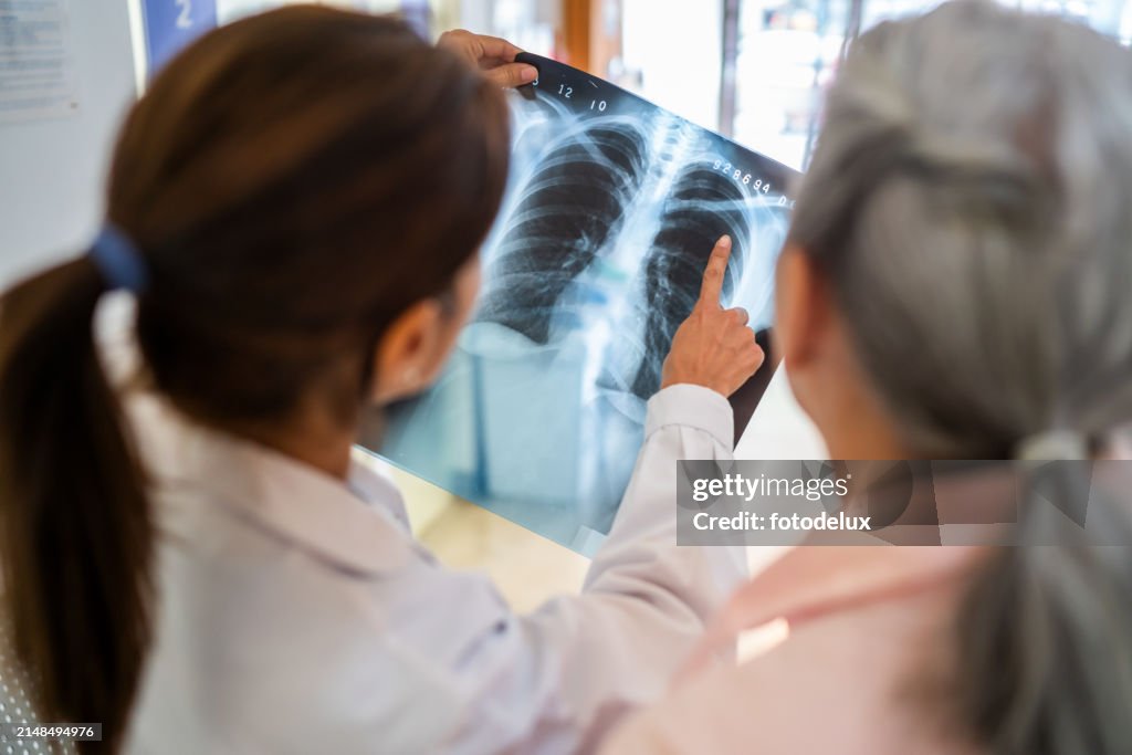 Doctors Analyzing a Chest X-Ray in Hospital