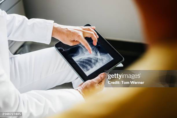 female doctor reviewing chest x-ray on tablet - hueso humano fotografías e imágenes de stock