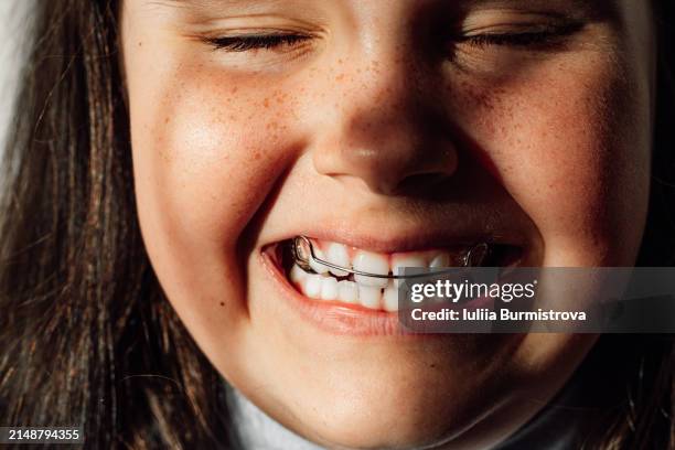 removable orthodontic retainers on the child's teeth, bite correction and prevention of dental problems - apparecchio ortodontico foto e immagini stock