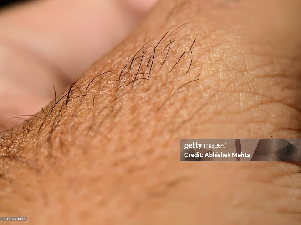 Goosebumps