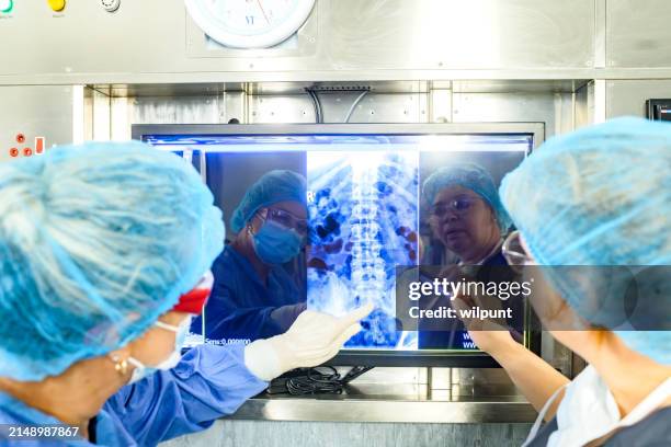 rear view female surgeons front reflections looking at spine x-ray in surgery discussing medical procedure - xray light box stock pictures, royalty-free photos & images