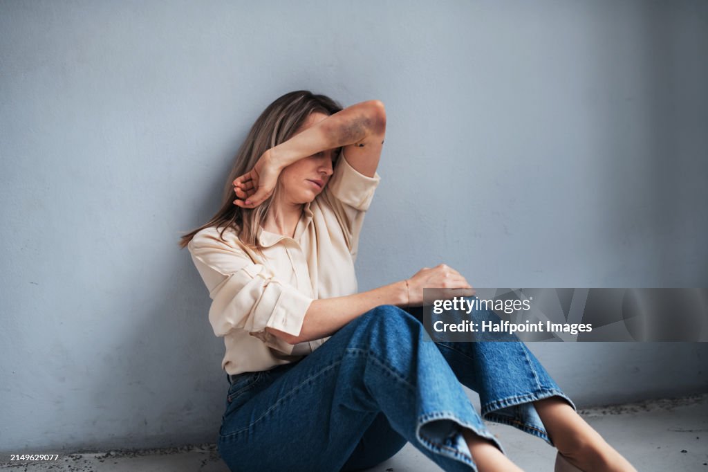 Portrait of woman with bruises on arms, feeling hopeless, having problems with harassment in work. Desperate abused woman showing her hands. Domestic violence and abuse, sexual harassment.