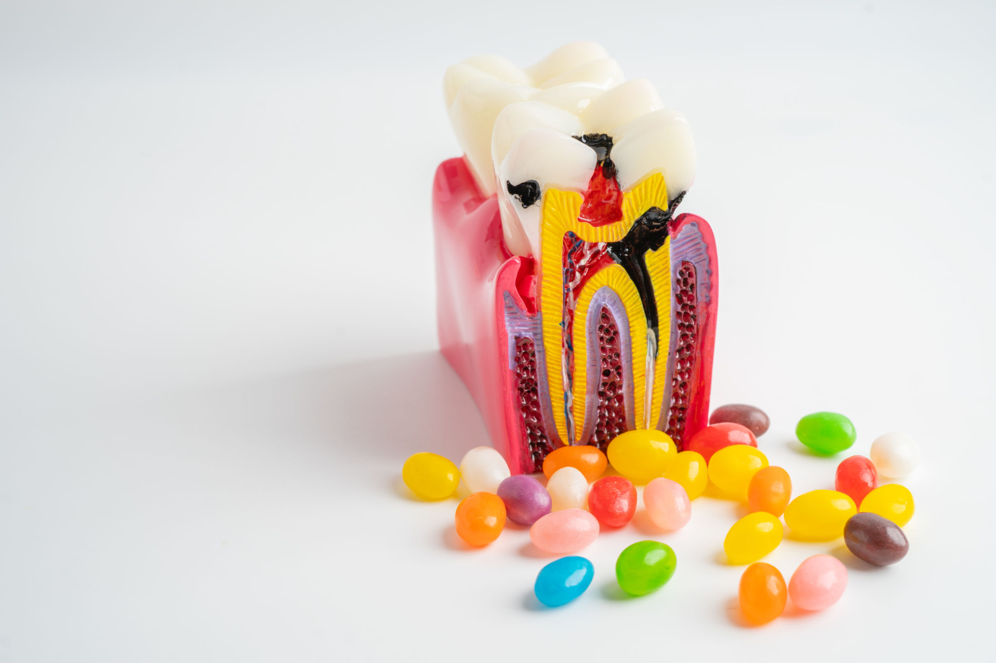 sugar and teeth
