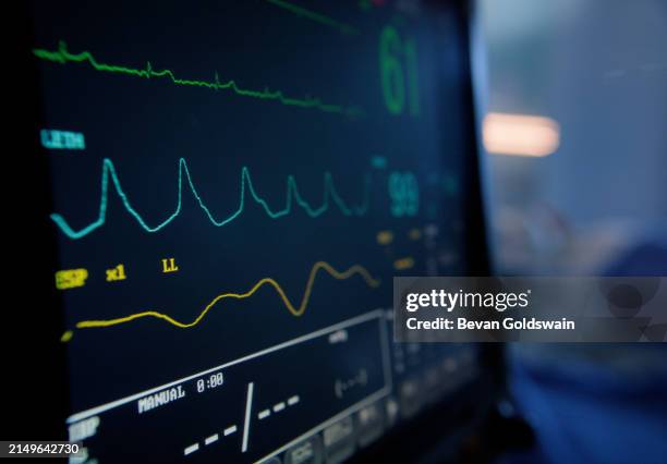 vital signs monitor, digital and hospital with ekg machine, electronic and medical equipment to help. emergency, stats and computer in icu, clinic and healthcare, life and science with technology - bewakingsapparatuur stockfoto's en -beelden