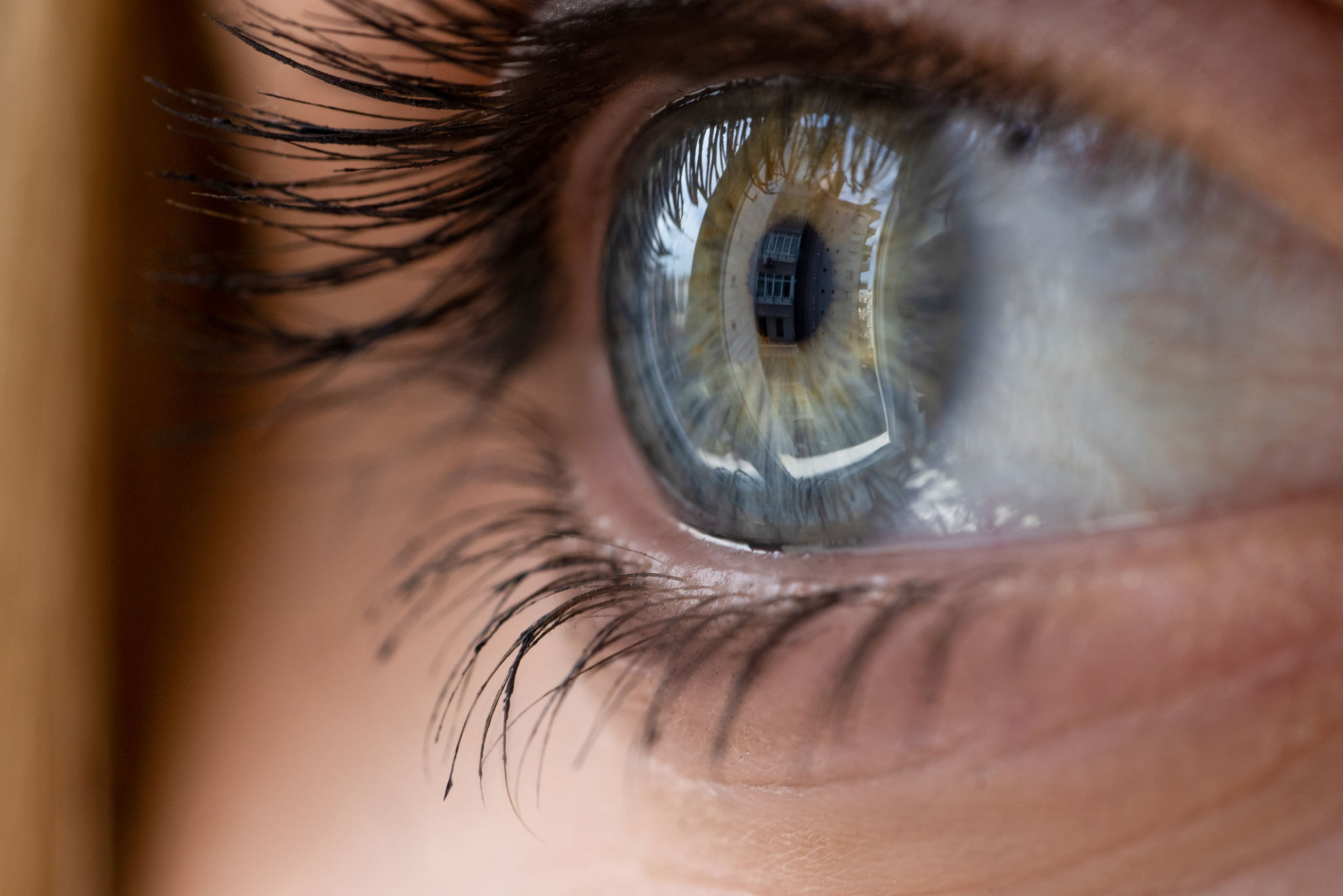 laser treatment