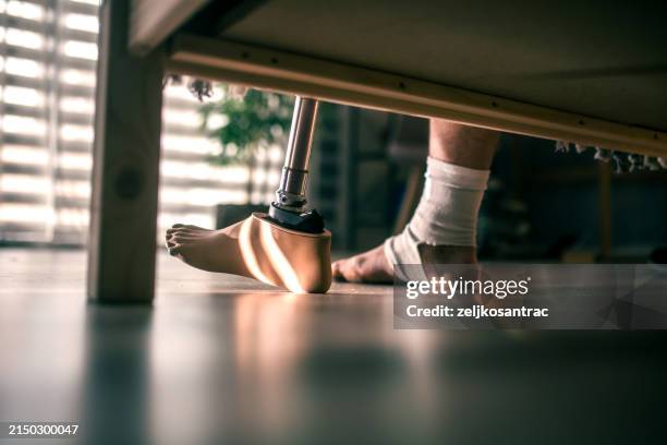 sportif amputé de la jambe qui se réveille et met sa prothèse de jambe - amputé photos et images de collection