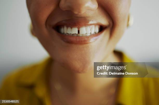 le sourire le plus éclatant - dentition humaine photos et images de collection