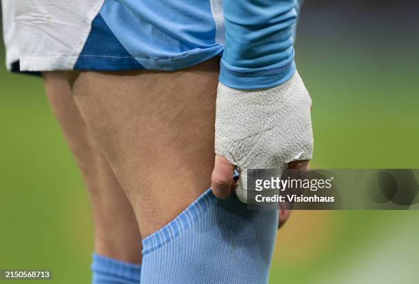 The bandaged hand of Phil Foden of Manchester City during the UEFA Champions League quarter-final second leg match between Manchester City and Real...
