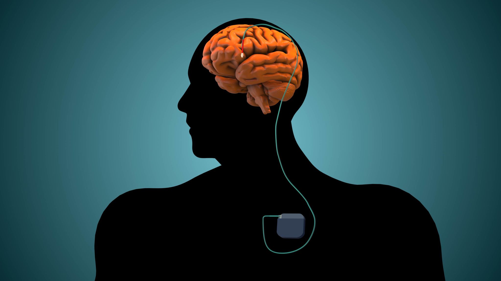 brain stimulation