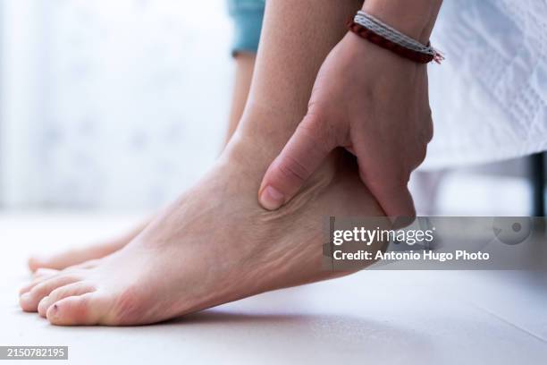 woman's hands caressing the discomfort in her heel - hinchado-inflamación fotografías e imágenes de stock