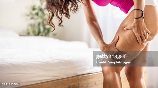 a young woman is checking her legs in the bedroom because she has symptoms of cellulite. partially naked woman. - cellulite stock pictures, royalty-free photos & images