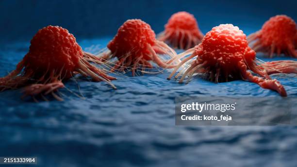 visualizzazione delle cellule tumorali - tumore metastatico foto e immagini stock