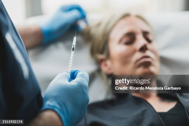 focused application of hyaluronic acid treatment - botulinetoxine injectie stockfoto's en -beelden