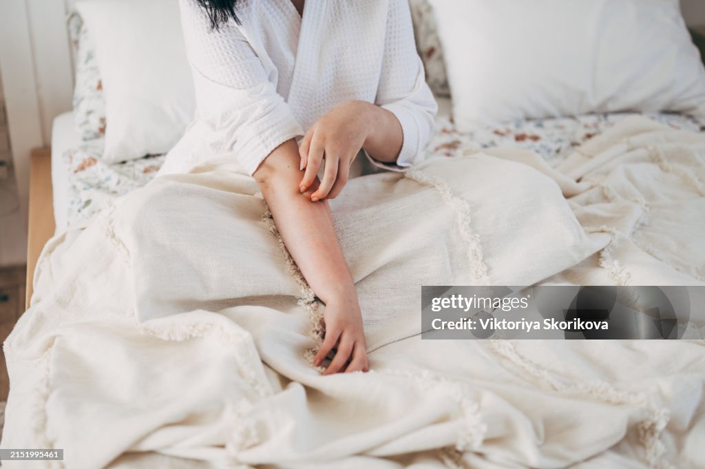 Sensitive skin allergic concept, Woman itching on her arm have a red rash from allergy symptom and from scratching.