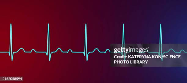 ecg displaying first degree av block, illustration - av stock illustrations