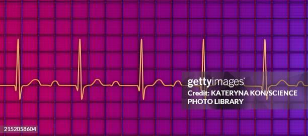 ecg displaying first degree av block, illustration - cardiac arrhythmia stock illustrations