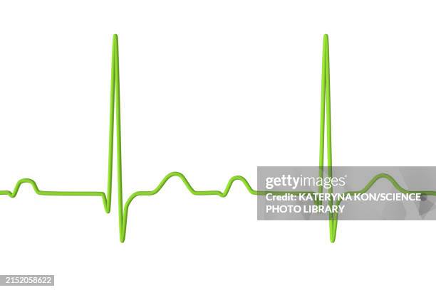 ecg displaying first degree av block, illustration - av stock illustrations