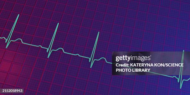 ecg with second degree av block, illustration - av stock illustrations