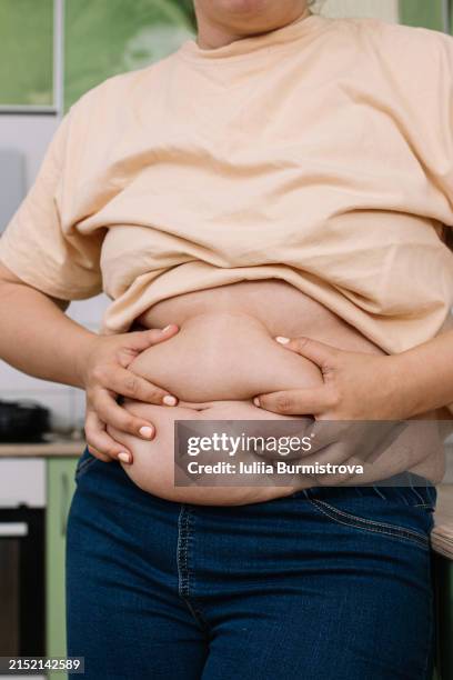 plus-size woman squeezes folds on a thick and fat belly with hands - överviktig bildbanksfoton och bilder