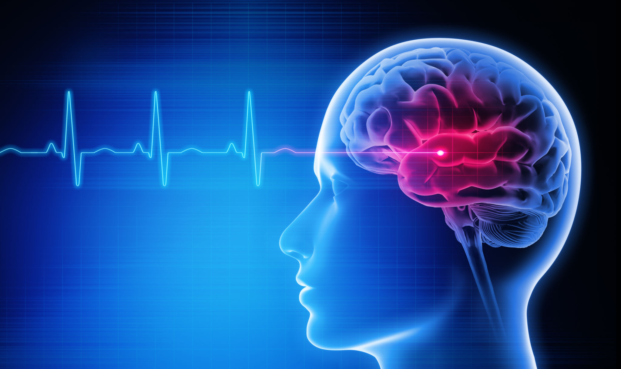brain health