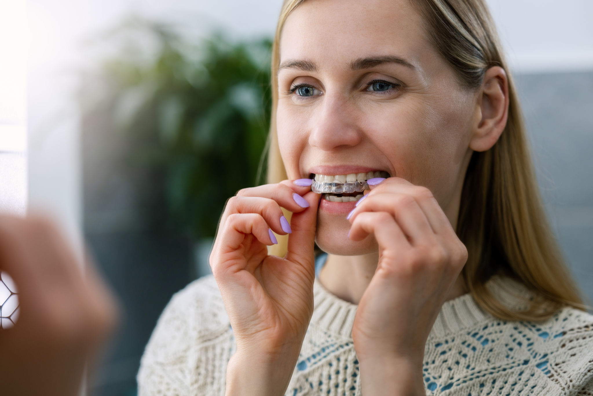 braces fitting