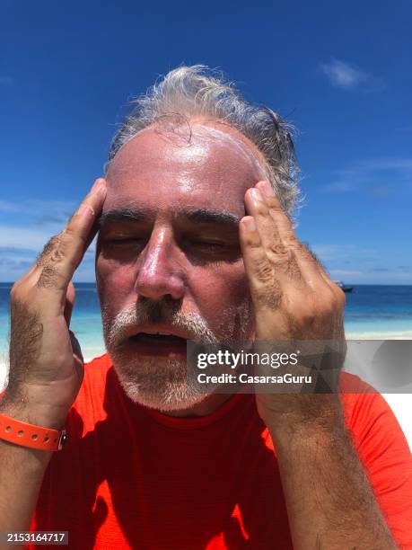 sunburned mature man portrait on a tropical beach - hyperthermia stock pictures, royalty-free photos & images
