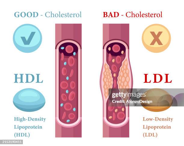 stockillustraties, clipart, cartoons en iconen met types of cholesterol in the blood concept. high-density lipoprotein (hdl) and low-density lipoprotein (ldl). - coronary arteries diagram