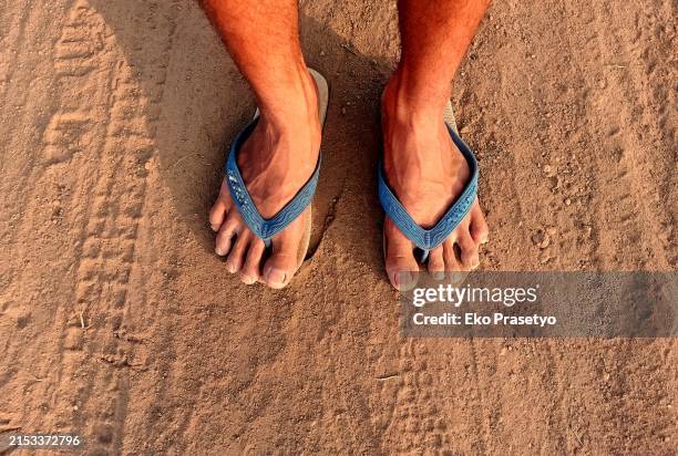 feet wearing flip-flops are in bad condition - badelatsche stock-fotos und bilder
