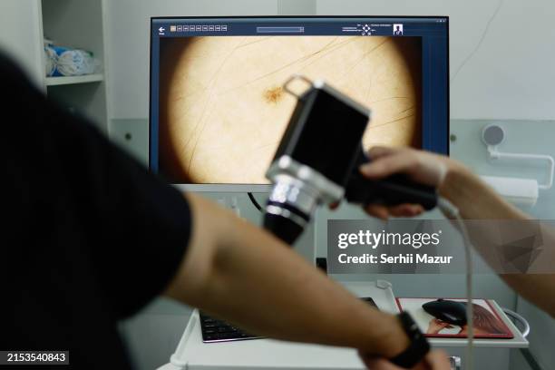 dermatological skin examination - stock photo - melanoma stock pictures, royalty-free photos & images