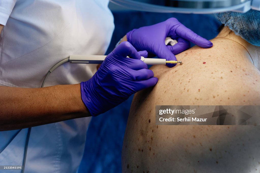 Dermatological Skin Examination - stock photo