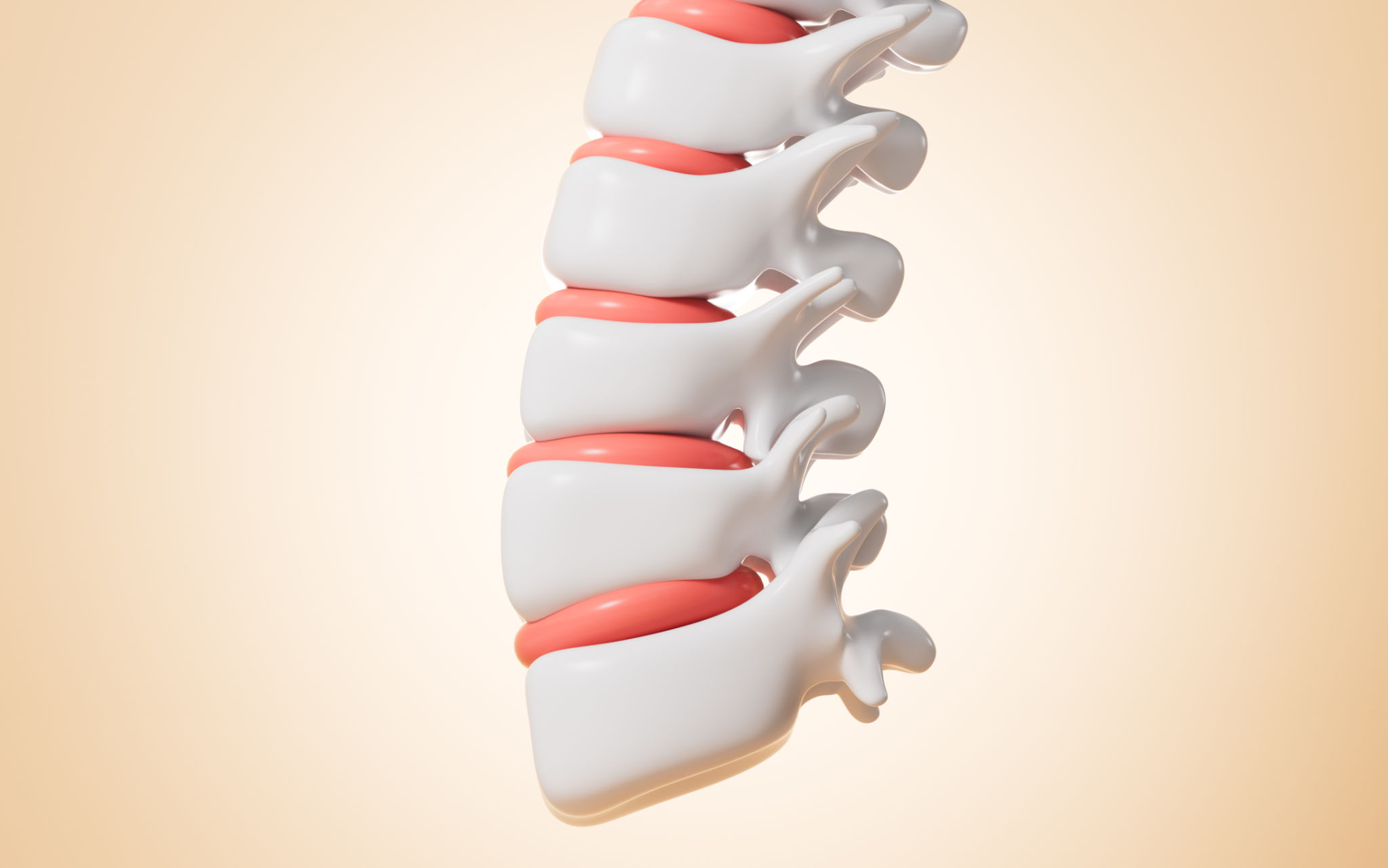 3d model orthopedic