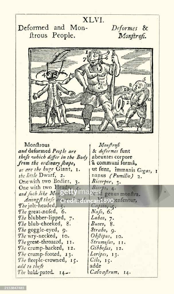 Medical history, Types of deformities in human body, Vintage Illustration, 18th Century